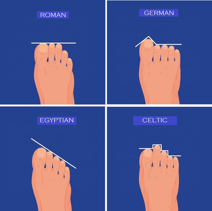 Classification of the Foot Shapes
