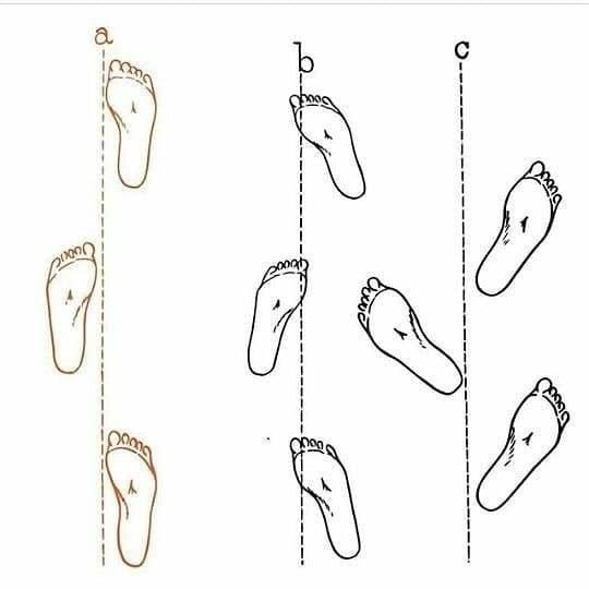 Do you have correct Gait?