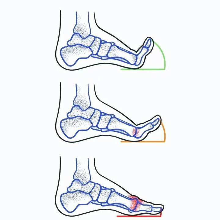 CAN YOUR BIG TOE DO THIS